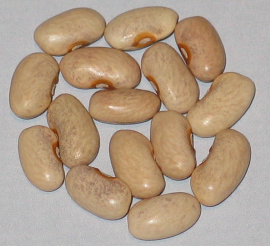 #32-93-DS-44-#5.1 Paynesville Kidney Seg.jpg