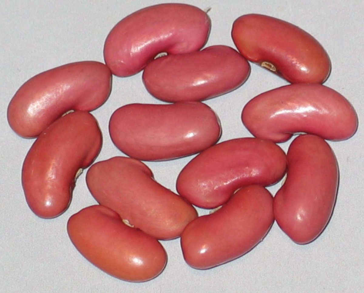 #32-93-DS-44-#5 Paynesville Kidney.jpg