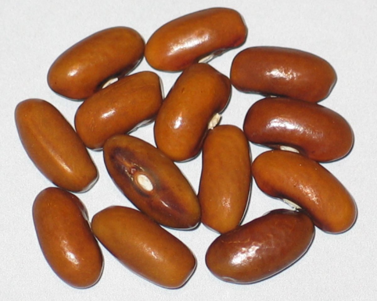 brownkidney2016.jpg