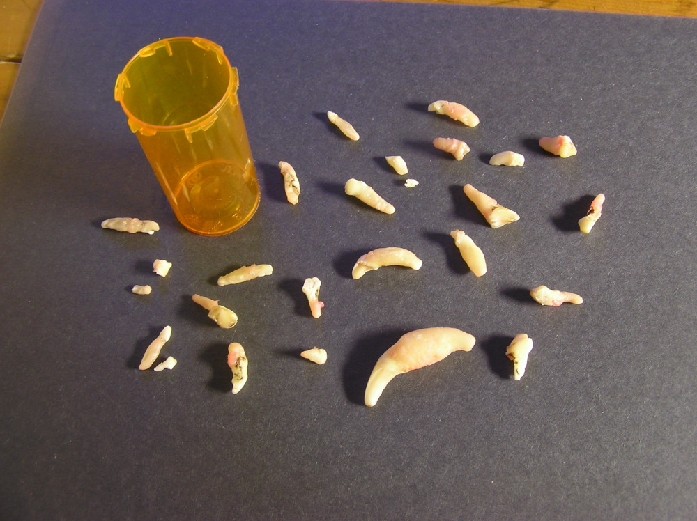 MabelsExtractedTeeth.JPG